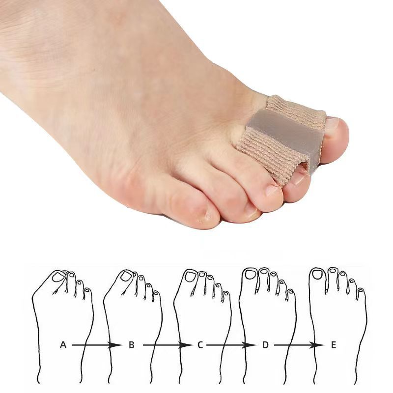 Fiber Toe Separator - My Store