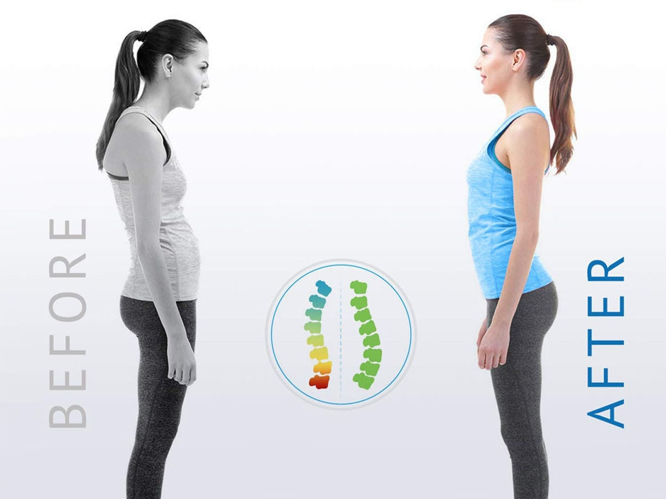 Posture Corrector - My Store